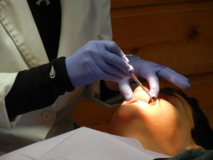 tipos de extracción dental
